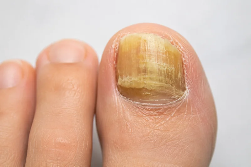 Tırnak görünümüne yönelik profesyonel bakım uygulaması